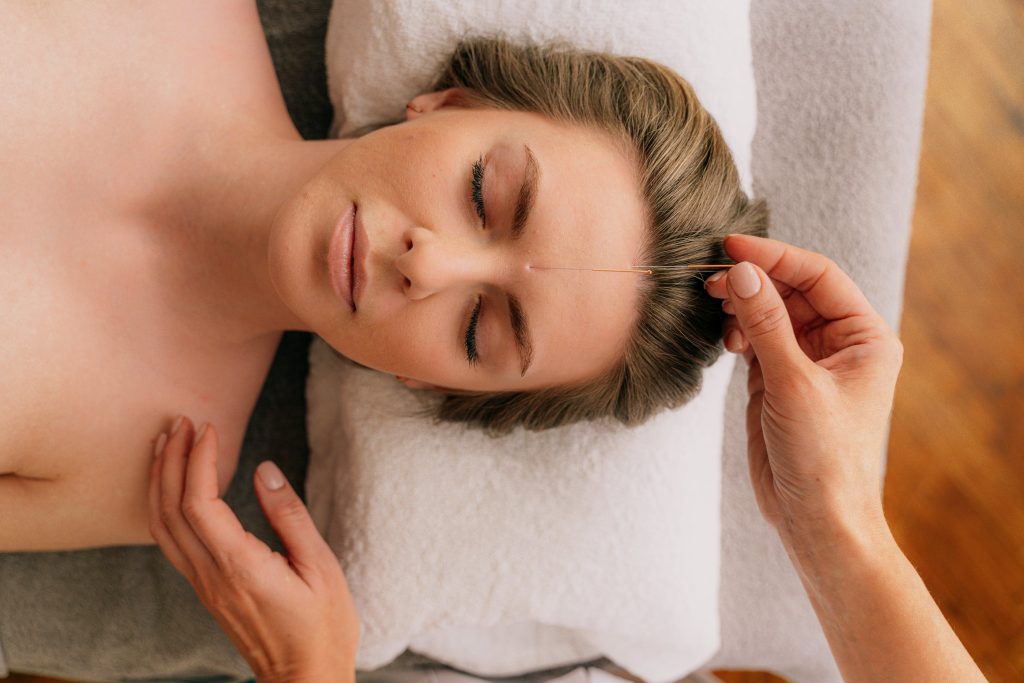 The Benefits of Facial Acupuncture